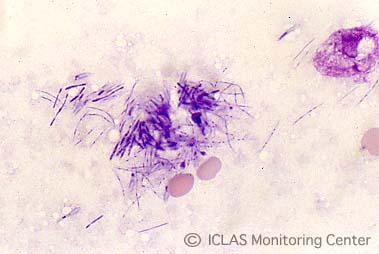 右: <i>C. piliforme</i> 実験感染ラットの肝臓割面スタンプ標本 (May-Giemsa染色)