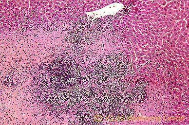 <i>C. kutscheri</i> 感染ラットの肝組織 (H&E染色像) : 化膿性肝炎