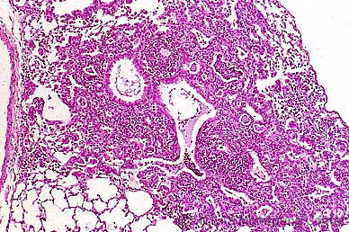 Sendai virus実験感染マウスの肺組織 (H&E染色像) : 気管支性肺炎