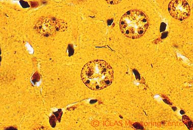 右: <i>H. hepaticus</i> 実験感染SCIDマウスの肝組織 (Warthin-Starry染色像) : 肝毛細胆管腔内に好銀性の螺旋状桿菌