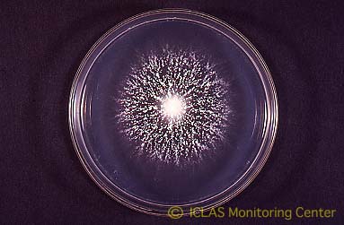左: 白癬菌コロニー (ポテトデキストロース寒天培地、25℃、2週間培養)