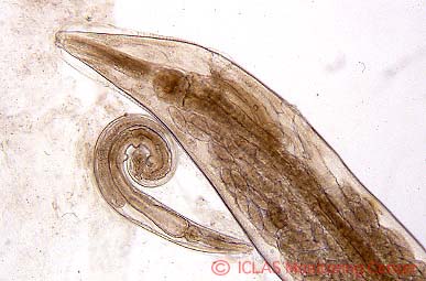 左: <i>S. obvelata</i>  (ネズミ盲腸蟯虫) 成虫: 光学顕微鏡像