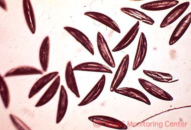 右: <i>S. obvelata</i> (ネズミ盲腸蟯虫) 虫卵: 光学顕微鏡像