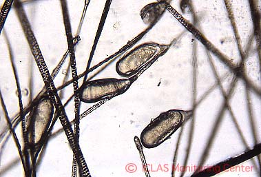 右: <i>M. musculi</i>  (ハツカネズミケモチダニ) 虫卵がマウス被毛に付着