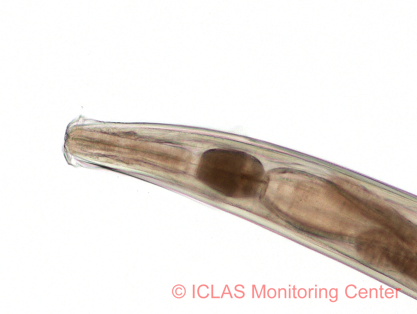右: <i>A. tetraptera</i> 雌成虫頭部の光学顕微鏡像拡大